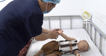 500 trẻ mắc tay chân miệng nhập viện Nhi Trung ương, bệnh có thể biến chứng gây tử vong