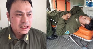 Xử lý nghiêm “cò” taxi đánh gãy răng nhân viên an ninh Nội Bài