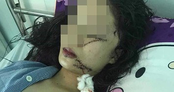 Nguyên nhân 2 thiếu nữ rạch mặt nhau kinh hoàng ở Bắc Ninh