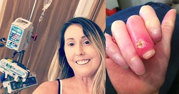 Mắc bệnh lạ, người phụ nữ buộc phải cắt ngón tay, ngón chân 30 lần 