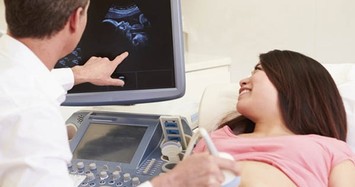 Bác sĩ choáng vì biểu cảm thai nhi cực lạ lùng khi siêu âm 4D