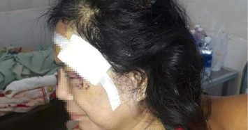 Chồng đánh vợ cũ dã man ở Phú Yên: Tại sao phụ nữ mãi khổ?