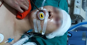 Hà Nội: Nam sinh bị đánh trọng thương ngay cửa nhà