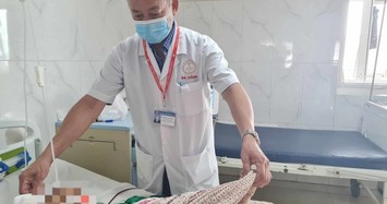 Bé trai 12 tuổi ở Đắk Lắk bị trúng đạn vào đầu
