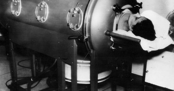 Biết gì về những máy thở đầu tiên trong lịch sử?