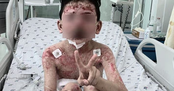 Bé trai ở Kiên Giang mắc bệnh lạ nguy hiểm sau 2 ngày ăn cua