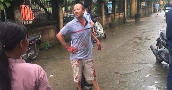 Vụ thảm sát 4 người trong gia đình tử vong ở Hà Nội: Hé lộ nguyên nhân