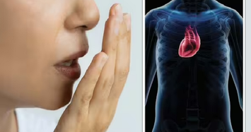 Nguy cơ mắc bệnh tim cao hơn nếu nhiễm vi khuẩn gây hôi miệng 
