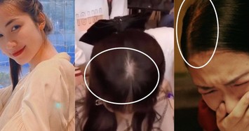 Hòa Minzy rụng tóc, lý do vì sao?