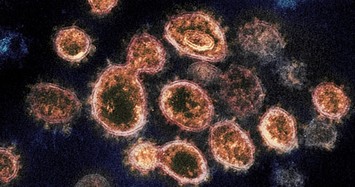 Biết gì về chủng virus gây bệnh COVID-19 ở Hải Dương?