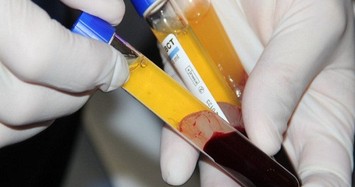 Điều trị COVID-19 bằng huyết tương làm giảm tỷ lệ tử vong?