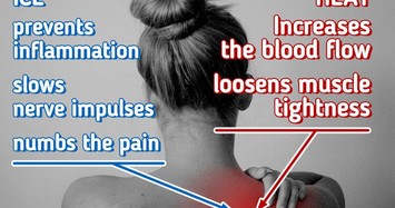 Những cách giúp giảm đau ở cổ và lưng hiệu quả