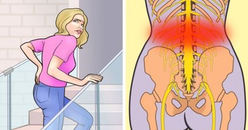 7 thói quen gây đau lưng mà bạn cần sửa ngay lập tức
