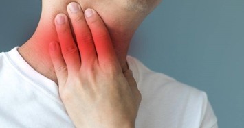 Những biểu hiện đau họng cảnh báo ung thư tuyến giáp