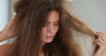 3 biểu hiện của tóc cho thấy gan có vấn đề