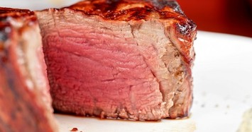 Ăn quá nhiều thịt đỏ tăng nguy cơ mắc thận mãn tính