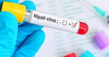 Virus Nipah bùng phát, tỷ lệ tử vong tới 75%