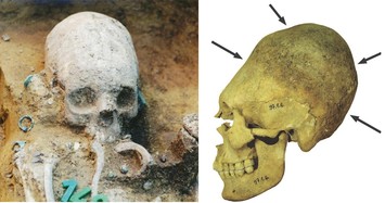 Người La Mã cổ đại thực hiện tập tục kéo dài hộp sọ trẻ em thế nào?