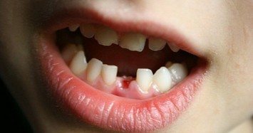 Những sự thật khó tin về bộ răng của con người