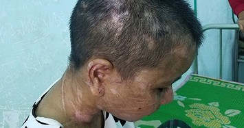 Người làm thuê bị tra tấn dã man: Chủ tịch tỉnh Gia Lai chỉ đạo khẩn