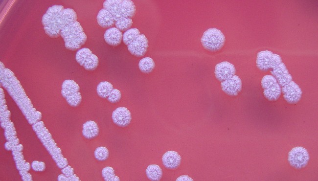 Bệnh Whitmore 'vi khuẩn ăn thịt người' nguy hiểm cỡ nào?
