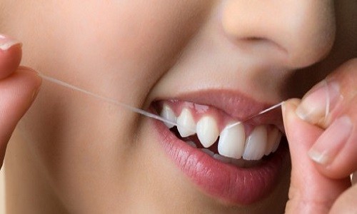 Sử dụng chỉ nha khoa làm sạch răng như thế nào mới đúng cách?