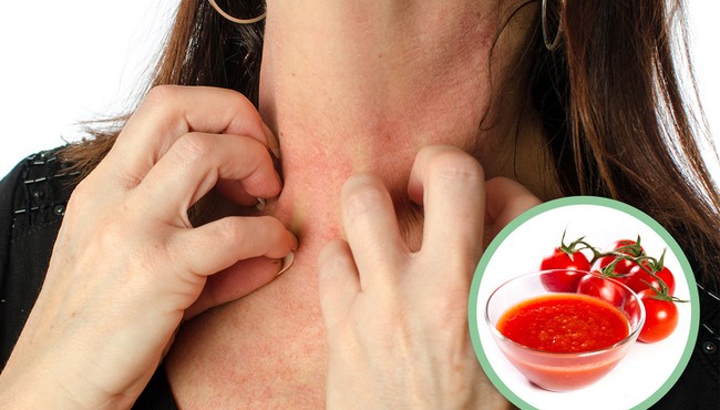 Cà chua - sát thủ âm thầm với nhiều loại bệnh