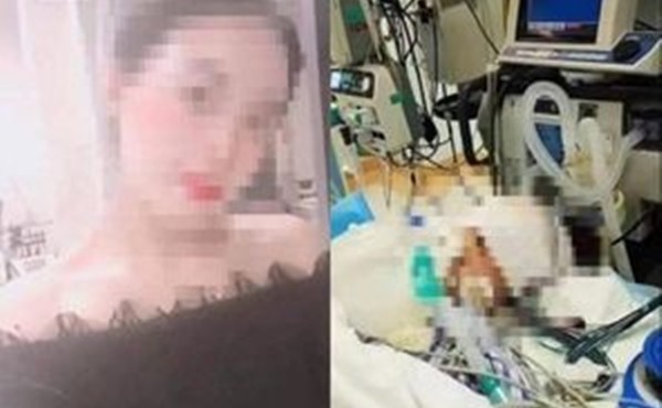 Cô gái tử vong sau phẫu thuật thẩm mỹ nâng mũi 