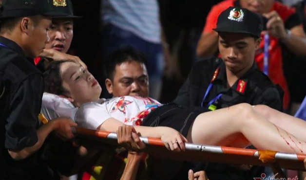 Cổ động viên nữ bê bết máu vì dính pháo sáng trong trận Nam Định thua CLB Hà Nội