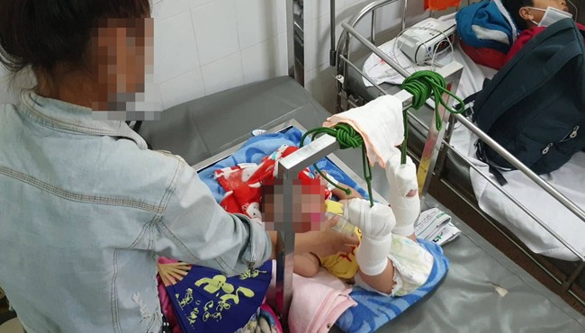 Bắt giam người cha bạo hành con ruột 4 tháng tuổi xuất huyết não, gãy xương ở Sài Gòn