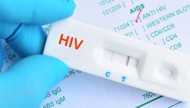 Một số biện pháp được khuyến cáo giúp phòng ngừa lây nhiễm HIV