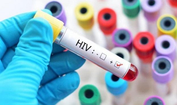 Những yếu tố nào khiến việc điều trị HIV thất bại?