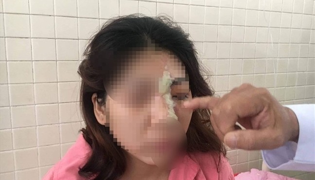 Cô gái  21 tuổi mù mắt sau khi làm đẹp tại spa