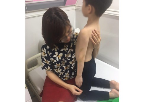 Hà Nội: Làm rõ nghi vấn bác sĩ bạo hành con mình