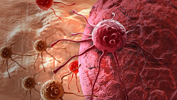 Thói quen sinh hoạt hàng ngày khiến nam giới dễ mắc ung thư hơn phụ nữ