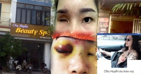 Spa Chu Huyền nói gì khi làm mù mắt cô gái tiêm filler nâng mũi?