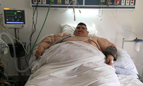 Người đàn ông béo nhất thế giới hy vọng có thể tự đi lại 