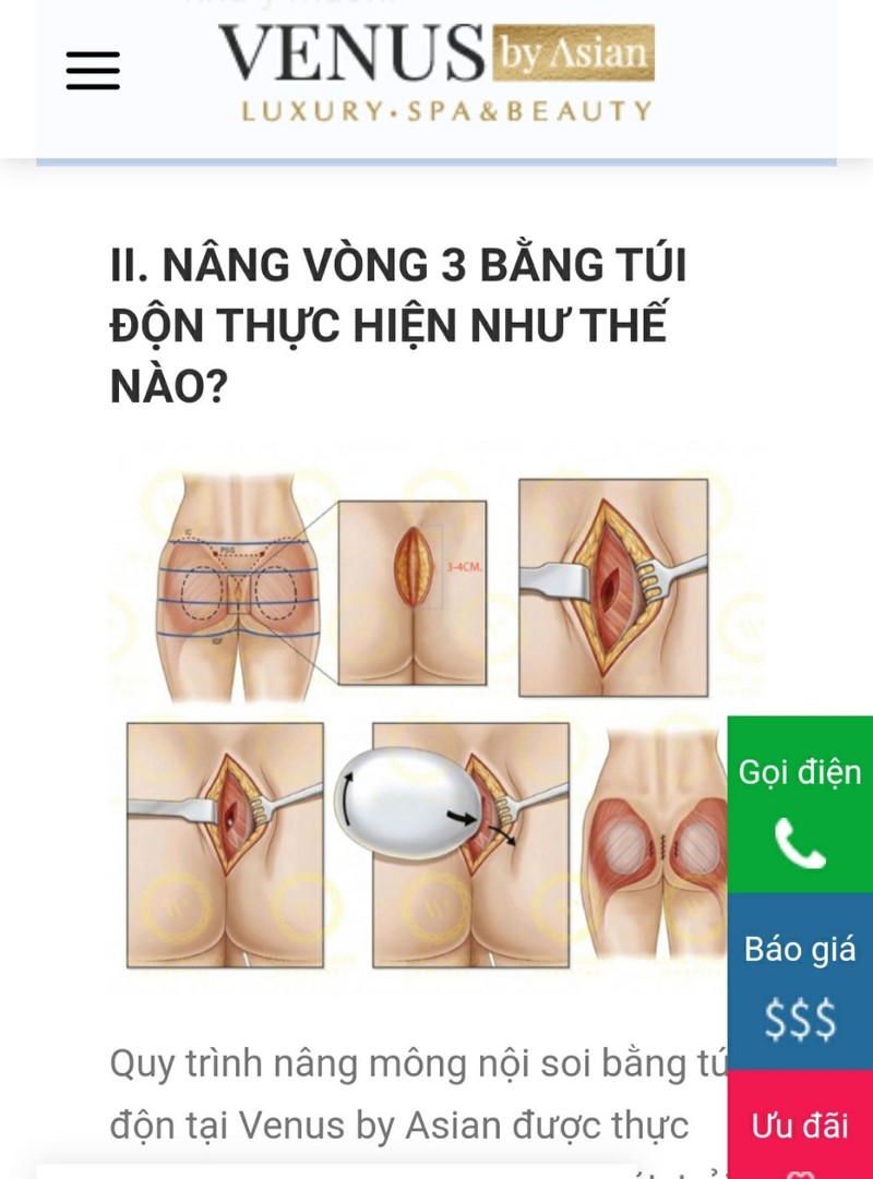 TP HCM: Tham my vien Venus by Asian hoat dong khong phep-Hinh-3