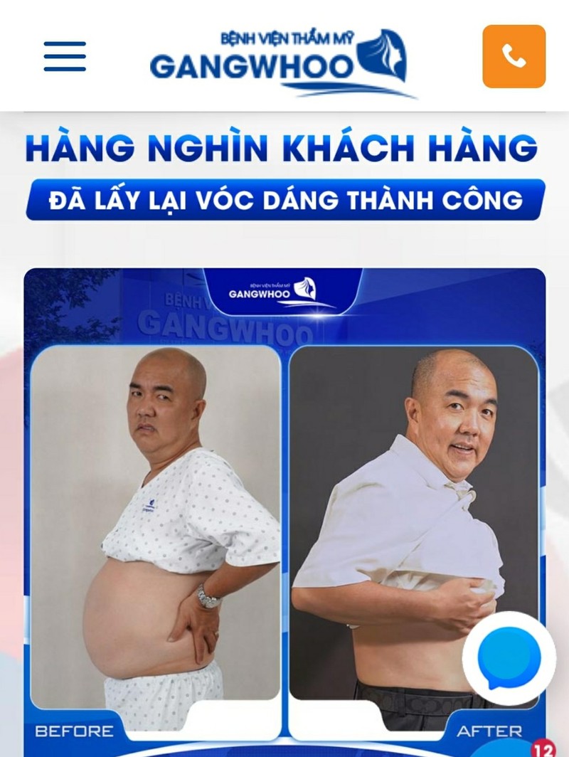 Benh vien tham my GangWhoo quang cao hut mo bung 'chay nhu nuoc may'-Hinh-3